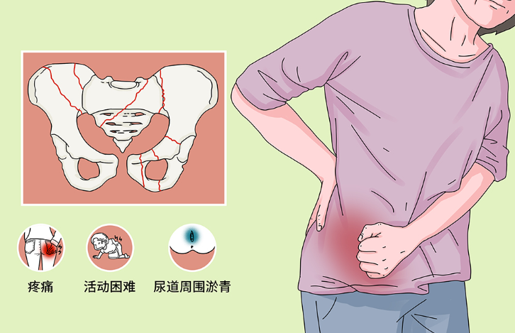 邵陽創(chuàng)傷骨科,邵陽風濕病區(qū),邵陽骨質增生,邵陽關節(jié)病區(qū),邵陽頸椎病區(qū)