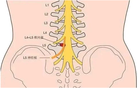 邵陽創(chuàng)傷骨科,邵陽風(fēng)濕病區(qū),邵陽骨質(zhì)增生,邵陽關(guān)節(jié)病區(qū),邵陽頸椎病區(qū)